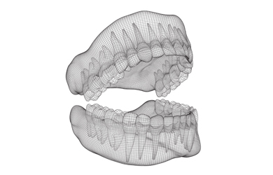 Dentadura en 3D