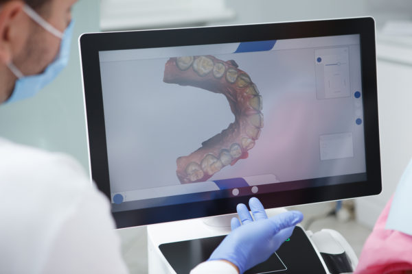 Cómo un laboratorio dental digital mejora la eficiencia de tu clínica