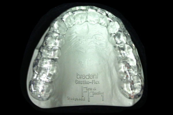 Férulas de Míchigan