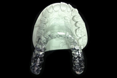 Férulas de mantenimiento