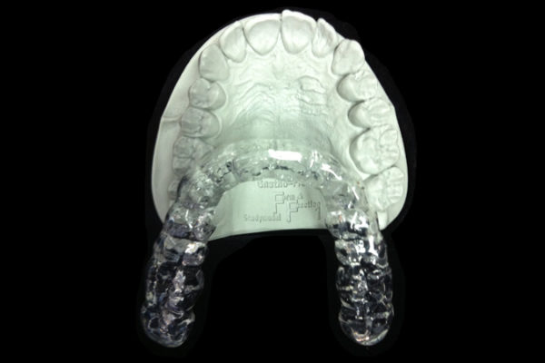 Férulas de mantenimiento