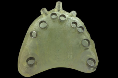 Férulas quirúrgicas