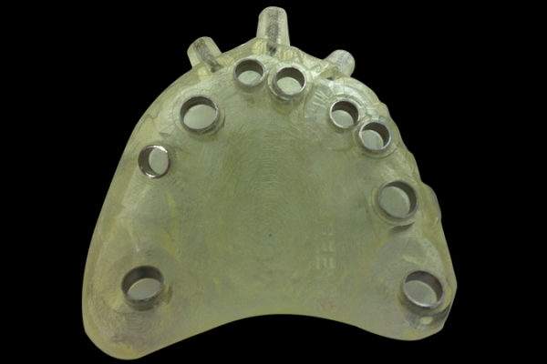 Férulas quirúrgicas