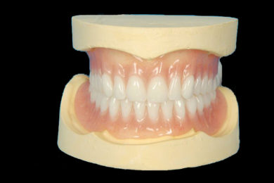 Prótesis removibles completas