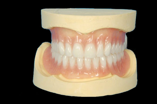 Prótesis removibles completas