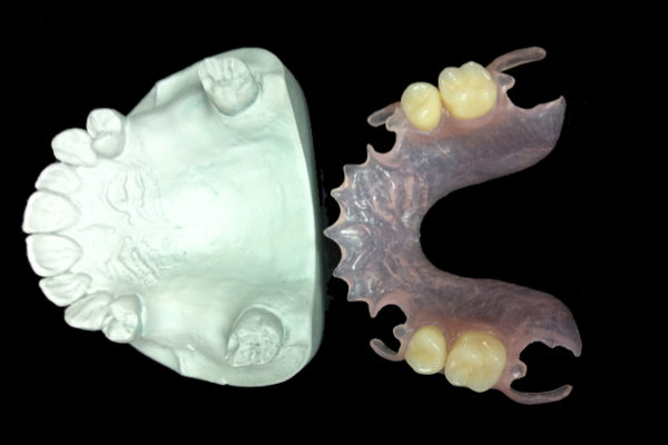 Parciales valplast (único laboratorio oficial en Valladolid)