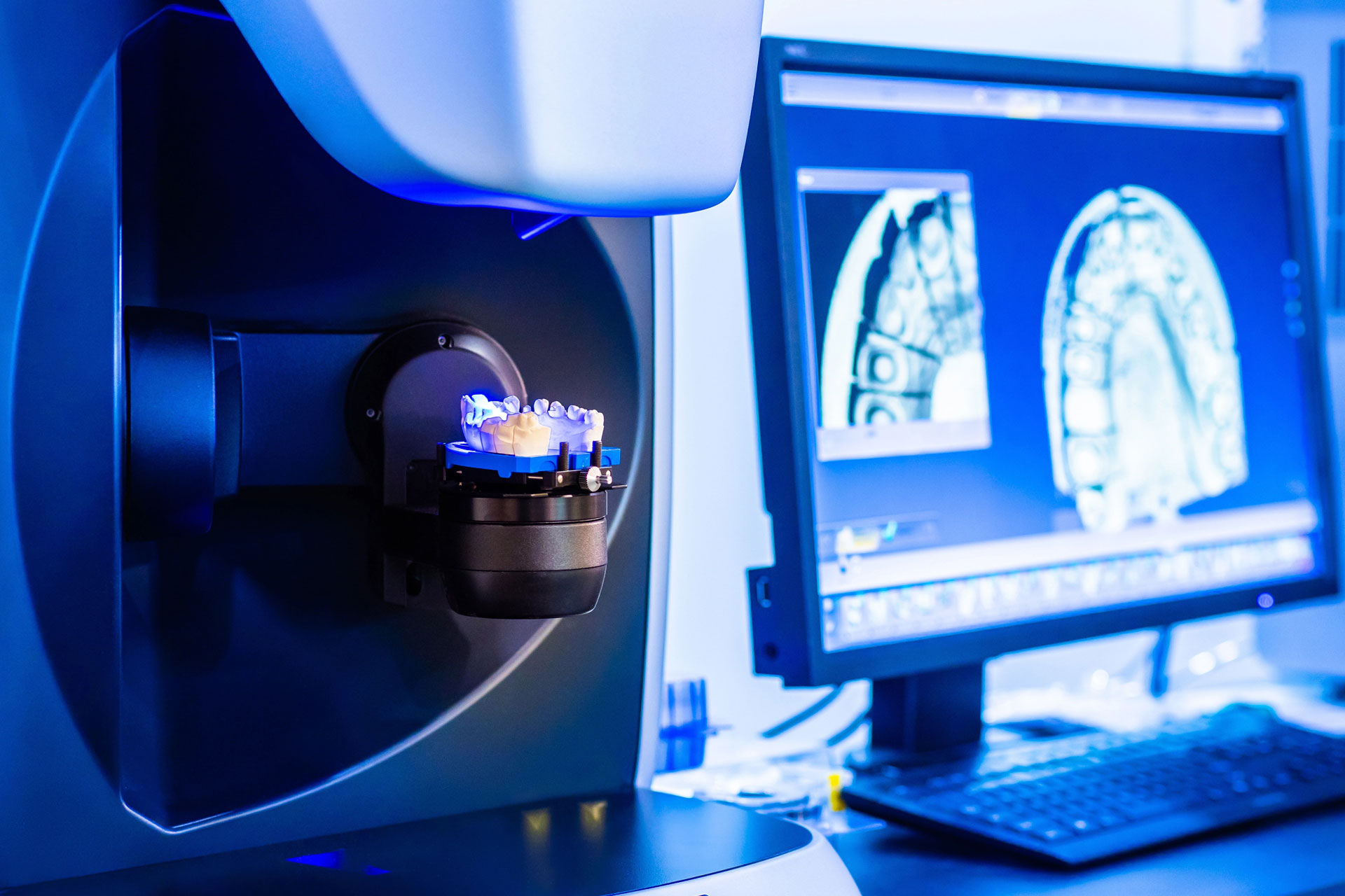 Tecnología 3D laboratorio dental